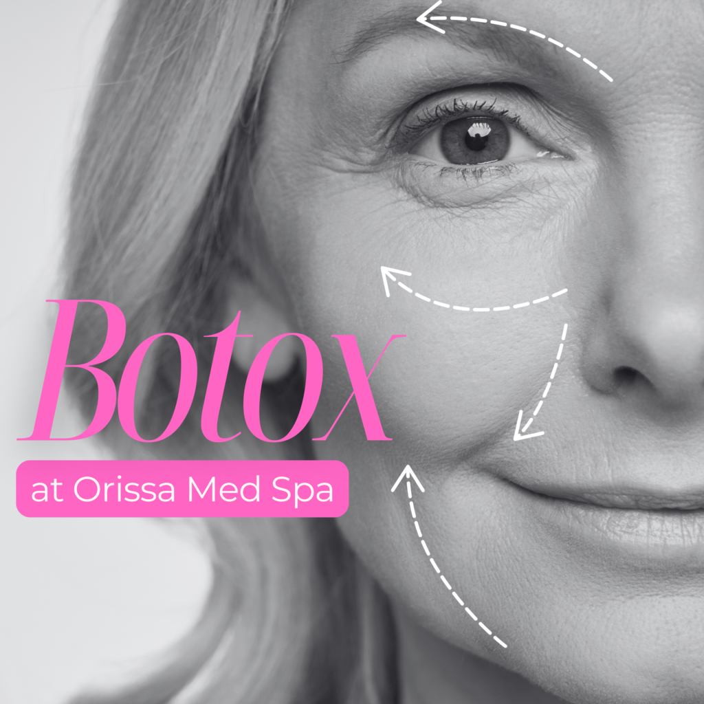 Botox Orissa Med Spa Chula Vista